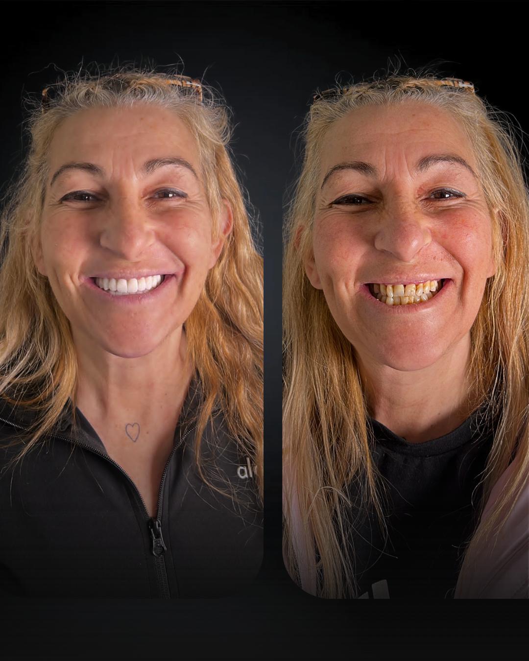 Before after 4