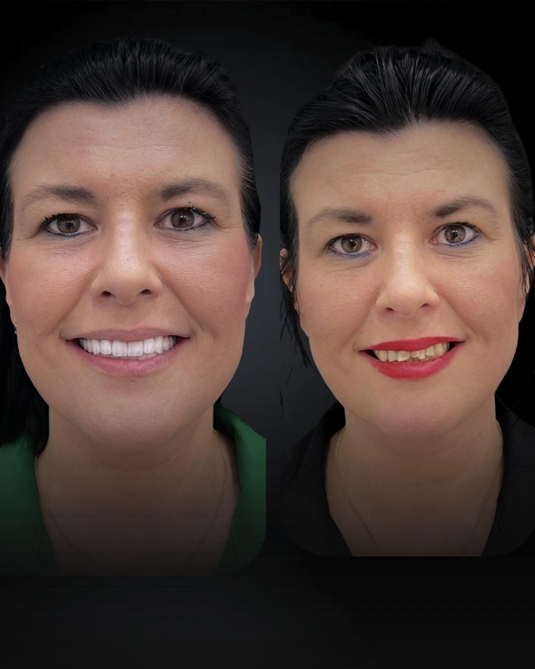 Before after 6